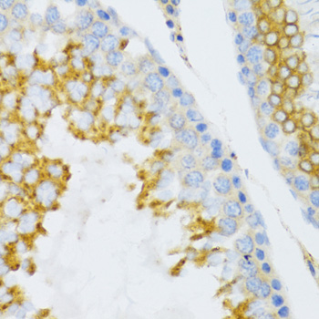 Immunohistochemistry - PTN Polyclonal Antibody 