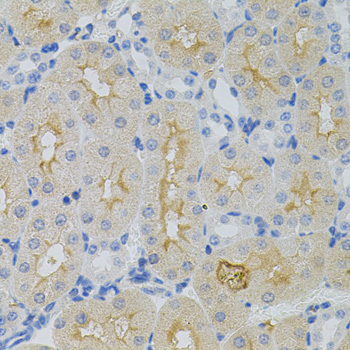 Immunohistochemistry - GNA13 Polyclonal Antibody 