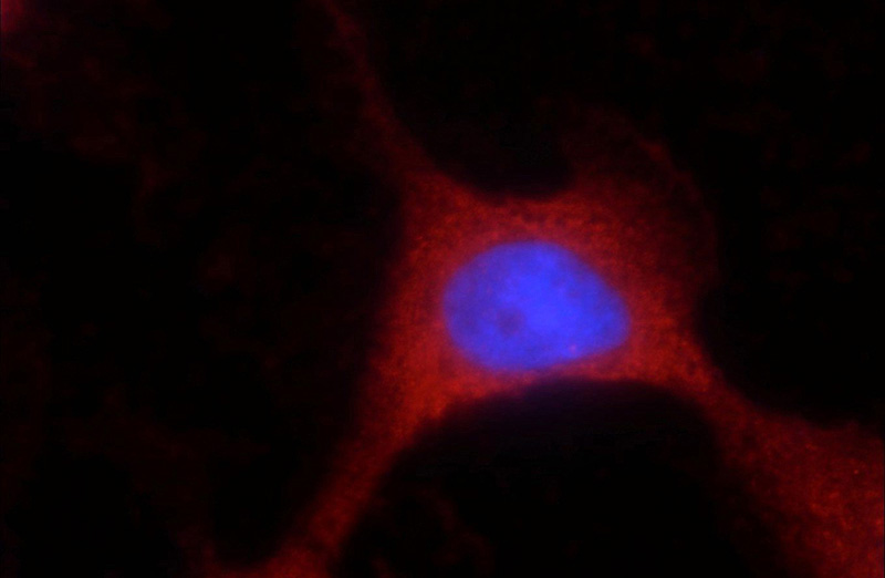 Immunofluorescent analysis of A431 cells using Catalog No:116661(UBQLNL Antibody) at dilution of 1:25 and Rhodamine-Goat anti-Rabbit IgG