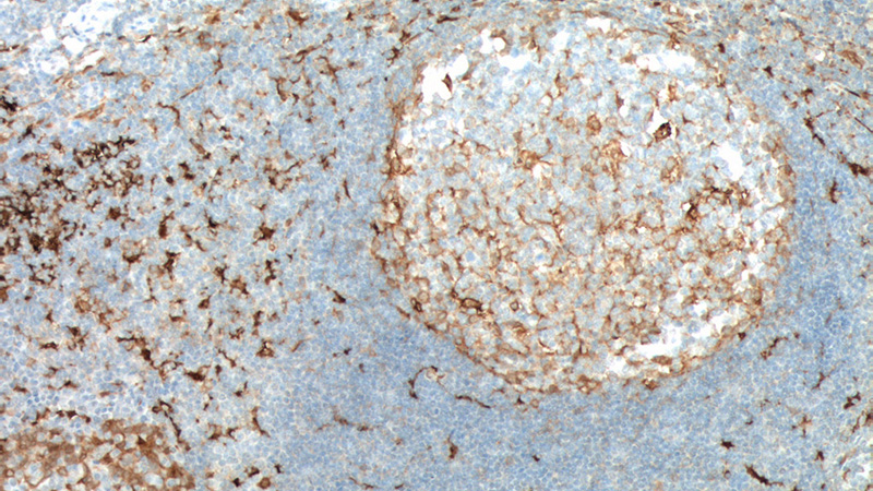 Immunohistochemistry of paraffin-embedded human tonsillitis tissue slide using Catalog No:107205(Fascin Antibody) at dilution of 1:600 (under 10x lens). Heat mediated antigen retrieved with Tris-EDTA buffer(pH9).