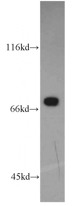 mouse small intestine tissue were subjected to SDS PAGE followed by western blot with Catalog No:114009(PLS1 antibody) at dilution of 1:1200