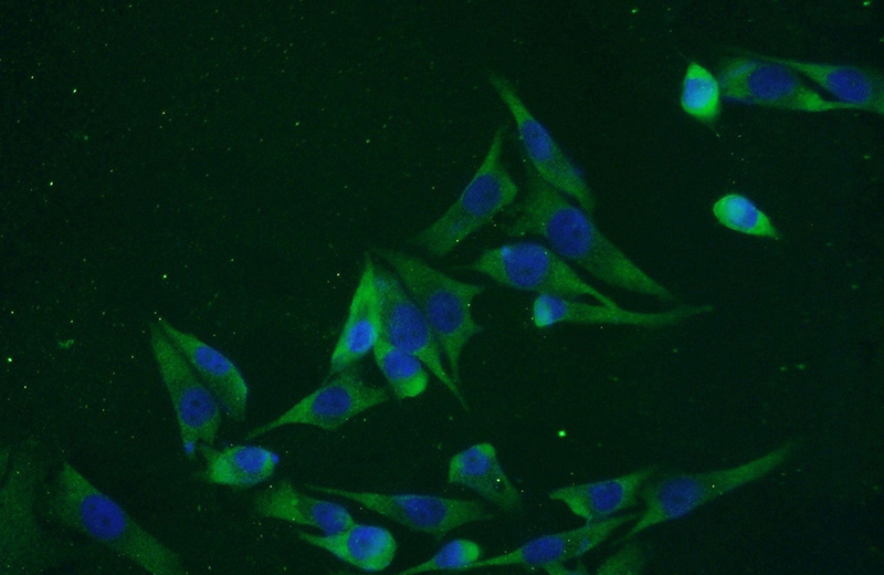 Immunofluorescent analysis of A375 cells using Catalog No:108792(C7orf58 Antibody) at dilution of 1:50 and Alexa Fluor 488-congugated AffiniPure Goat Anti-Rabbit IgG(H+L)