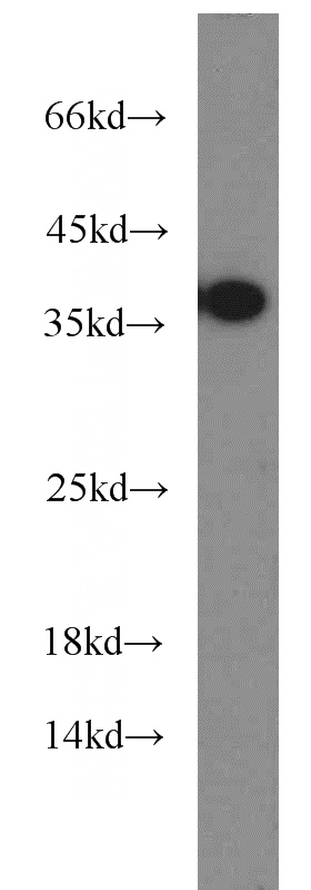 HepG2 cells were subjected to SDS PAGE followed by western blot with Catalog No:114294(PSAT1 antibody) at dilution of 1:600