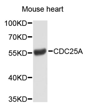 Western blot - CDC25A Polyclonal Antibody 