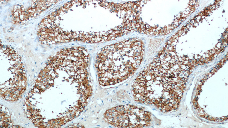 Immunohistochemical of paraffin-embedded human testis using Catalog No:109072(CCP1 antibody) at dilution of 1:50 (under 10x lens)