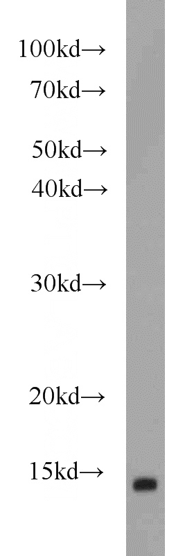 human brain tissue were subjected to SDS PAGE followed by western blot with Catalog No:110442(FABP7 antibody) at dilution of 1:800