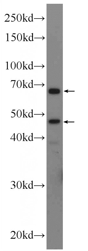 rat liver tissue were subjected to SDS PAGE followed by western blot with Catalog No:111077(SLC2A2 Antibody) at dilution of 1:300