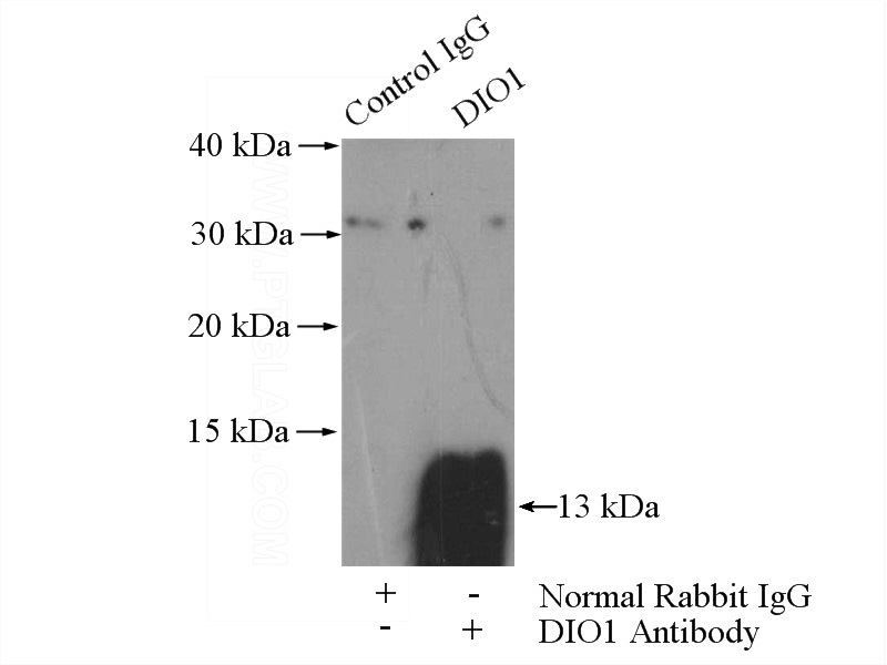 IP Result of anti-DIO1 (IP:Catalog No:109943, 4ug; Detection:Catalog No:109943 1:1000) with A549 cells lysate 1200ug.