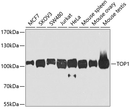 Western blot - TOP1 Polyclonal Antibody 