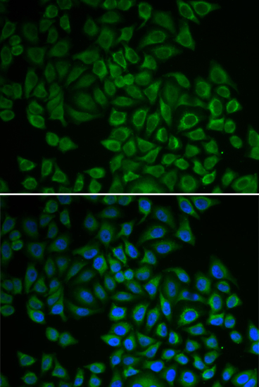 Immunofluorescence - SGK1 Polyclonal Antibody 
