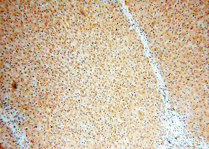 Immunohistochemical of paraffin-embedded human liver using Catalog No:112264(LACTB antibody) at dilution of 1:100 (under 10x lens)