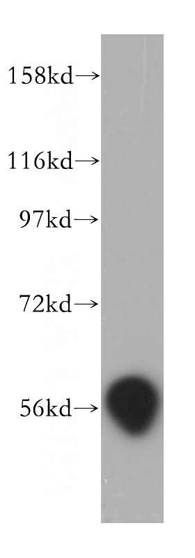 human liver tissue were subjected to SDS PAGE followed by western blot with Catalog No:109817(D2HGDH antibody) at dilution of 1:500