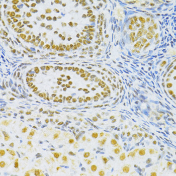 Immunohistochemistry - SNRNP70 Polyclonal Antibody 