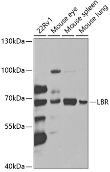 Western blot - LBR Polyclonal Antibody 
