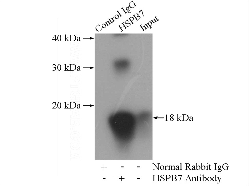 IP Result of anti-HSPB7 (IP:Catalog No:111701, 4ug; Detection:Catalog No:111701 1:500) with mouse skeletal muscle tissue lysate 3600ug.