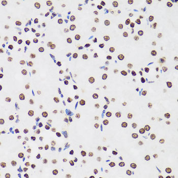 Immunohistochemistry - Histone H1.0 Polyclonal Antibody 