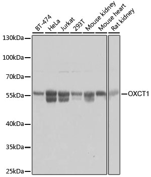 Western blot - OXCT1 Polyclonal Antibody 