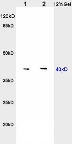 Fig2: Sample:; Heart(Rat) lysate at 30ug;; Brain(Rat) lysate at 30ug;; Primary: Anti-Nociceptin receptor at 1:200 dilution;; Secondary: HRP conjugated Goat-Anti-Rabbit IgG(bs-0295G-HRP) at 1: 3000 dilution;; Predicted band size : 40kD; Observed band size : 40kD