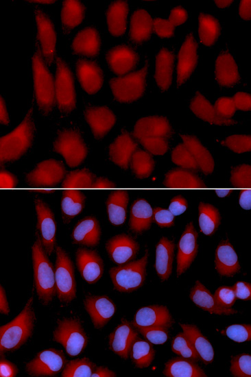 Immunofluorescence - TAP2 Polyclonal Antibody 