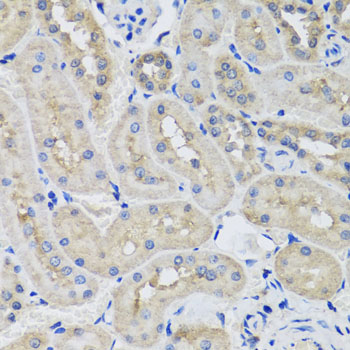 Immunohistochemistry - STK3 Polyclonal Antibody 