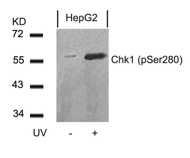 Western blot analysis of extracts from HepG2 cells untreated or treated with UV using Chk1 (Phospho-Ser280) Antibody .