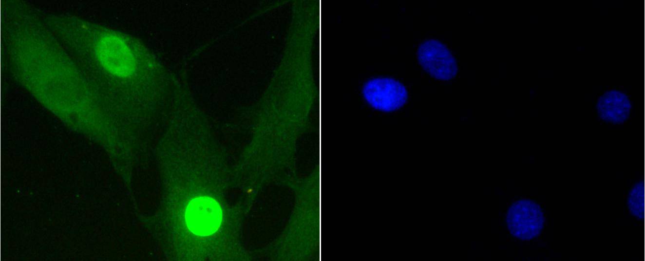 Fig2:; ICC staining of Phospho-Histone H1.3(T17)+Histone H1.4(T17) in NIH/3T3 cells (green). Formalin fixed cells were permeabilized with 0.1% Triton X-100 in TBS for 10 minutes at room temperature and blocked with 1% Blocker BSA for 15 minutes at room temperature. Cells were probed with the primary antibody ( 1/50) for 1 hour at room temperature, washed with PBS. Alexa Fluor®488 Goat anti-Rabbit IgG was used as the secondary antibody at 1/1,000 dilution. The nuclear counter stain is DAPI (blue).