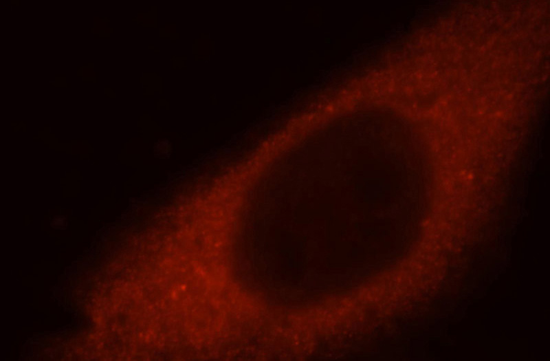 Immunofluorescent analysis of Hela cells, using BFSP1 antibody Catalog No:110665 at 1:25 dilution and Rhodamine-labeled goat anti-rabbit IgG (red).