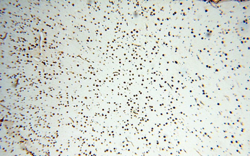 Immunohistochemical of paraffin-embedded human brain using Catalog No:113204(NKX2-5 antibody) at dilution of 1:100 (under 10x lens)
