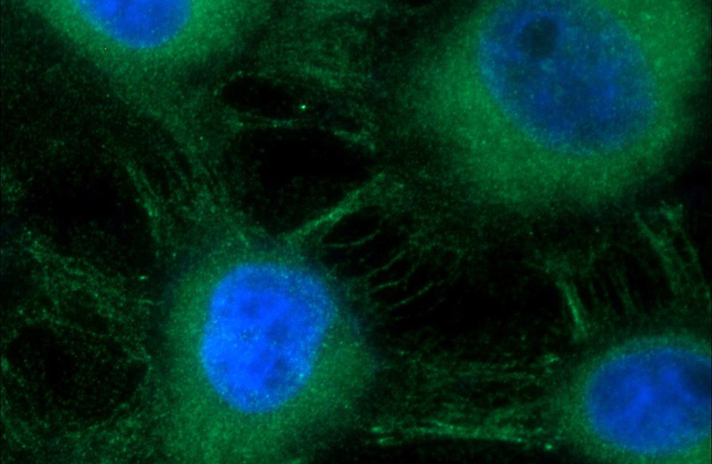Immunofluorescent analysis of A431 cells using Catalog No:113619(CDH3 Antibody) at dilution of 1:50 and Alexa Fluor 488-congugated AffiniPure Goat Anti-Rabbit IgG(H+L)