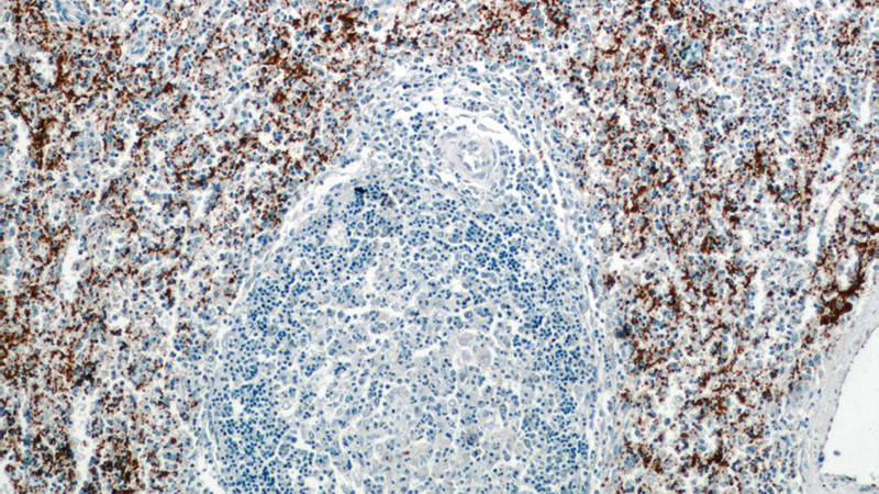Immunohistochemistry of paraffin-embedded human spleen slide using Catalog No:109121(ITGA2B Antibody) at dilution of 1:50