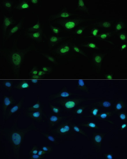 Immunofluorescence - MDC1 Polyclonal Antibody 