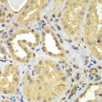 Immunohistochemistry - CIAO1 Polyclonal Antibody 