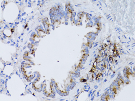 Immunohistochemistry - RARA Polyclonal Antibody 