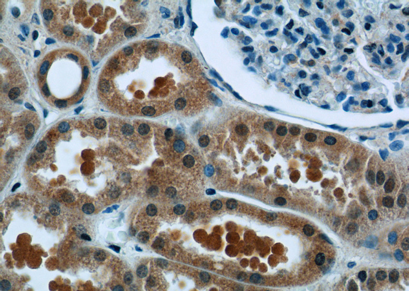 Immunohistochemistry of paraffin-embedded human kidney tissue slide using Catalog No:115919(TCTN1 Antibody) at dilution of 1:50 (under 40x lens)