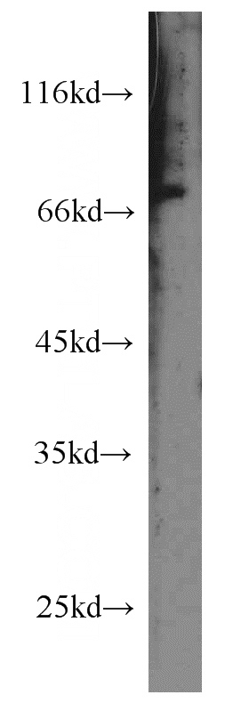 mouse eye tissue were subjected to SDS PAGE followed by western blot with Catalog No:113799(PHACTR4 antibody) at dilution of 1:400
