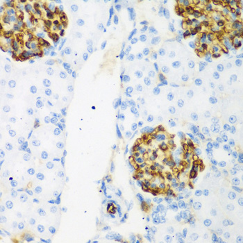 Immunohistochemistry - CSRNP1 Polyclonal Antibody 