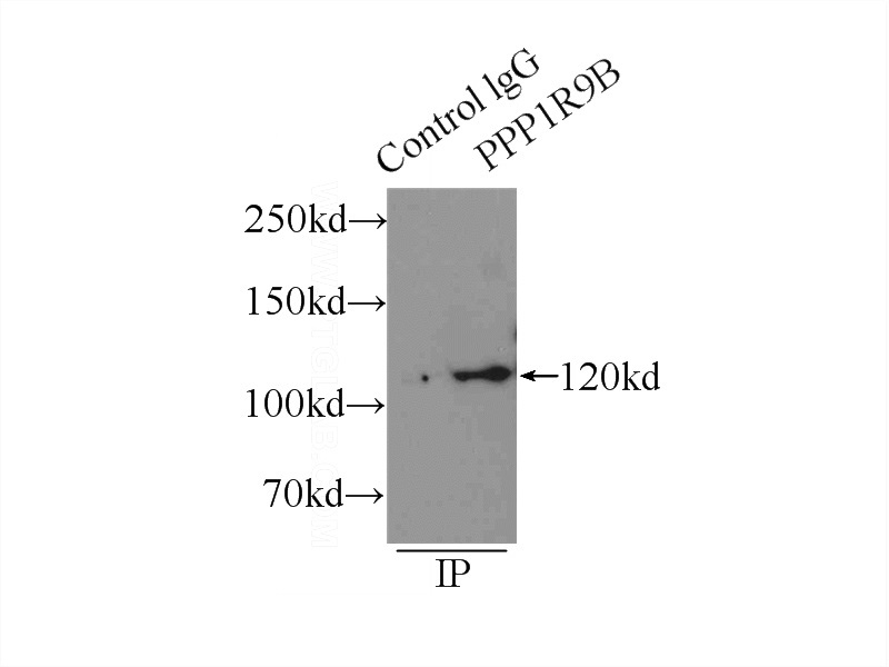 IP Result of anti-PPP1R9B (IP:Catalog No:114094, 4ug; Detection:Catalog No:114094 1:300) with mouse brain tissue lysate 6000ug.