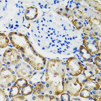 Immunohistochemistry - COMT Polyclonal Antibody 