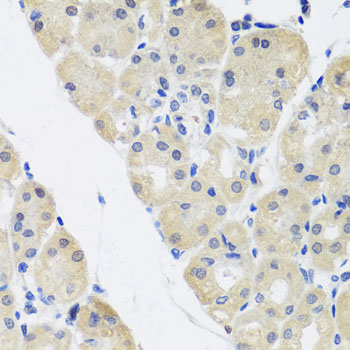 Immunohistochemistry - ALAD Polyclonal Antibody 