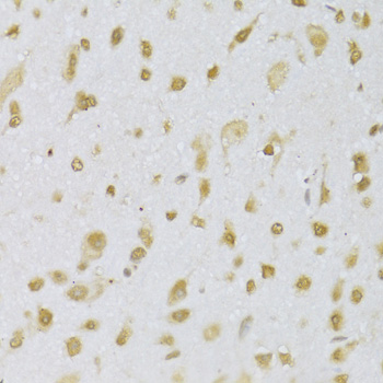 Immunohistochemistry - CBX8 Polyclonal Antibody 