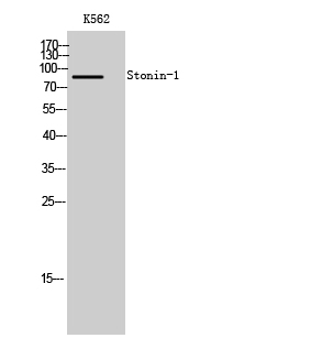Fig1:; Western Blot analysis of K562 cells using Stonin-1 Polyclonal Antibody