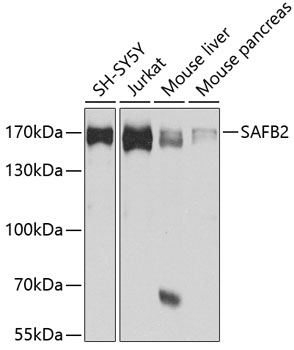 Western blot - SAFB2 Polyclonal Antibody 