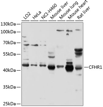 Western blot - CFHR1 Polyclonal Antibody 
