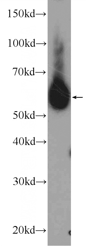 COLO 320 cells were subjected to SDS PAGE followed by western blot with Catalog No:109272(CHPF Antibody) at dilution of 1:1000