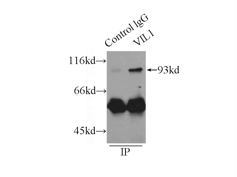 IP Result of anti-VIL1 (IP:Catalog No:107539, 4ug; Detection:Catalog No:107539 1:1000) with mouse kidney tissue lysate 6000ug.