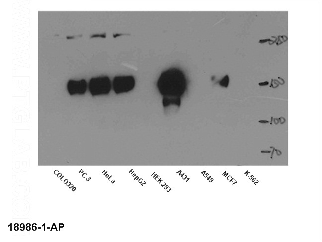 WB result of anti-EGFR (Catalog No:110218) in different cell lysates.