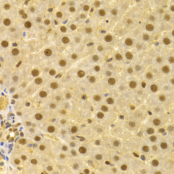 Immunohistochemistry - CDC25A Polyclonal Antibody 