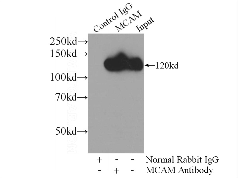 IP Result of anti-CD146, MCAM (IP:Catalog No:109054, 4ug; Detection:Catalog No:109054 1:1500) with HeLa cells lysate 4000ug.