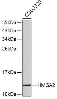 Western blot - HMGA2 Polyclonal Antibody 