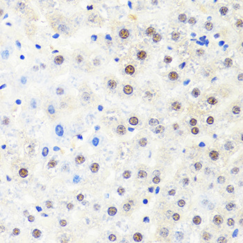 Immunohistochemistry - POLR2B Polyclonal Antibody 